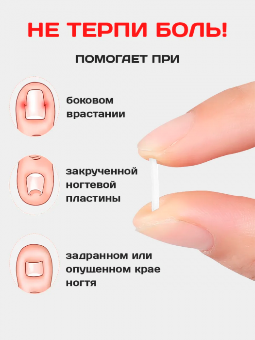 Корректор от вросших ногтей на ногах для педикюра