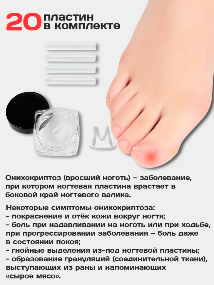 Корректор от вросших ногтей на ногах для педикюра